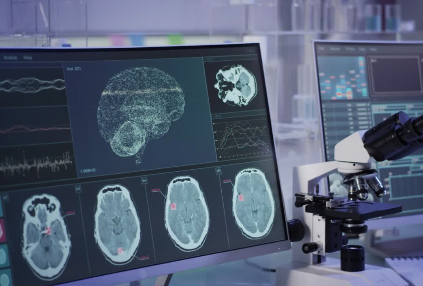 trastornos de neuropsiquiatría